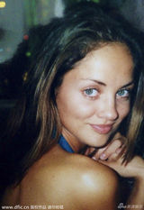 组图：30岁前英格兰小姐复出反抗割脸恐吓