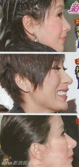 组图：杨怡被曝频整容拉近姐弟恋 丰唇变美
