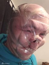 组图：蛇精病网友比赛胶带粘脸 集体不成人形