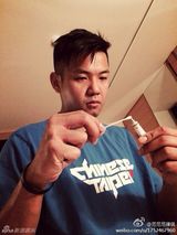 组图：范玮琪摔伤眉头缝20针老公 黑人贴心照顾