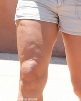 组图：布兰妮一身赘肉出门 大腿脂肪如月球表面