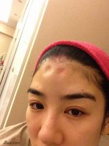 组图：黄奕晒家暴铁证 曾报警验伤老公写保证书