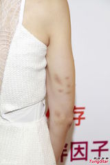 组图：周秀娜拍动作戏受伤 笑称要加片酬抵辛苦