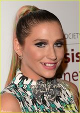 组图：Ke$ha卡通熊猫裤亮相 炫彩马尾辫镶金牙