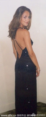 组图：30岁前英格兰小姐复出反抗割脸恐吓