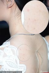 组图：刘亦菲不慎露胸垫 玉背瑕疵多蚊子包抢镜