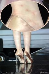 组图：刘亦菲不慎露胸垫 玉背瑕疵多蚊子包抢镜