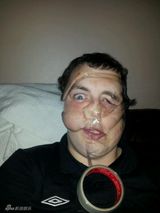 组图：蛇精病网友比赛胶带粘脸 集体不成人形