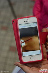 组图：陈静伤额入院缝13针 与女友人乐极生悲