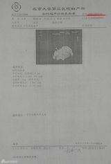 幻灯图:知情人提供方芳B超和医生笔录 称其自然流产