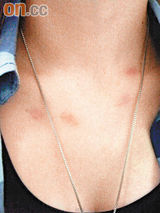 幻灯图：无线艺人崔建邦涉嫌打女友 女方已报警验伤