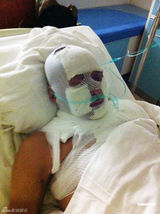 组图：齐秦烧伤痊愈公开露面 甜蜜展示妻女照片