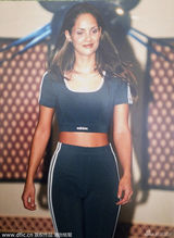 组图：30岁前英格兰小姐复出反抗割脸恐吓